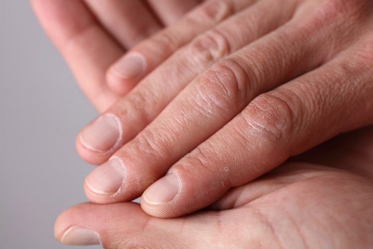 ناخن گیتاریست ها و مراقبت از آنها 19 ناخن گیتاریست ها و مراقبت از آنها